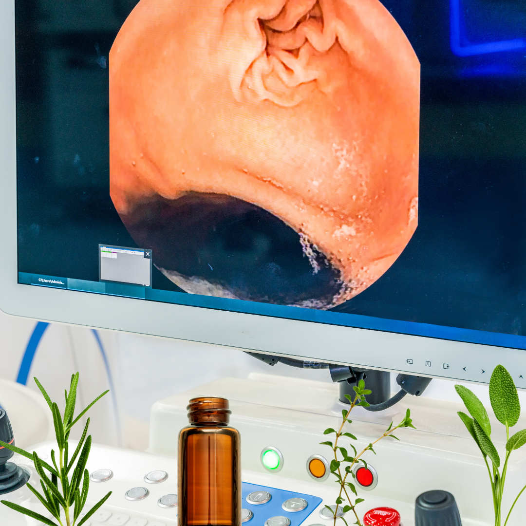 A computer screen showing an endoscopy of someone's throat.